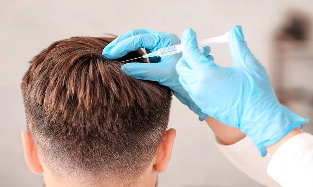 How Regenera Activa Fits into a Hair Loss Treatment Plan?